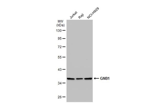 GNB1 Antibody in Western Blot (WB)