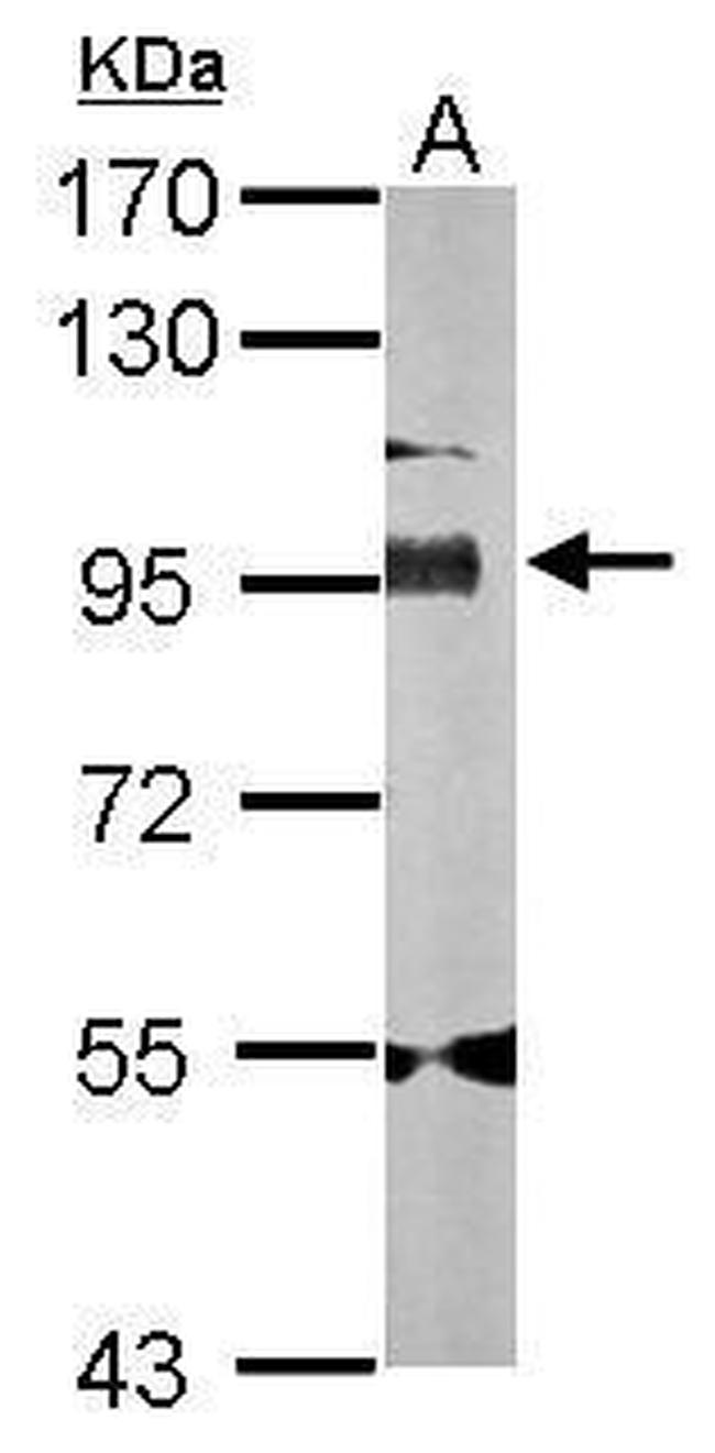 Golgin-97 Antibody in Western Blot (WB)