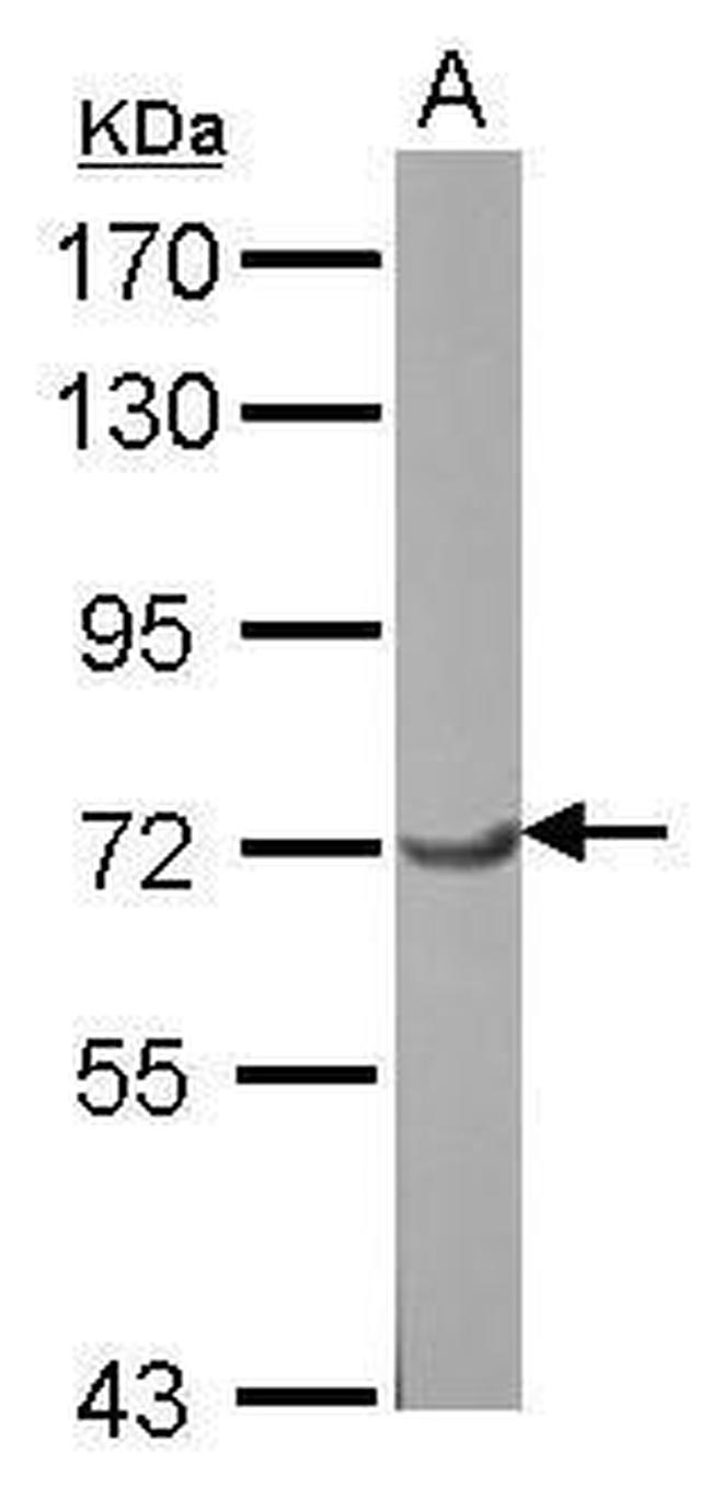 GTF2F1 Antibody in Western Blot (WB)