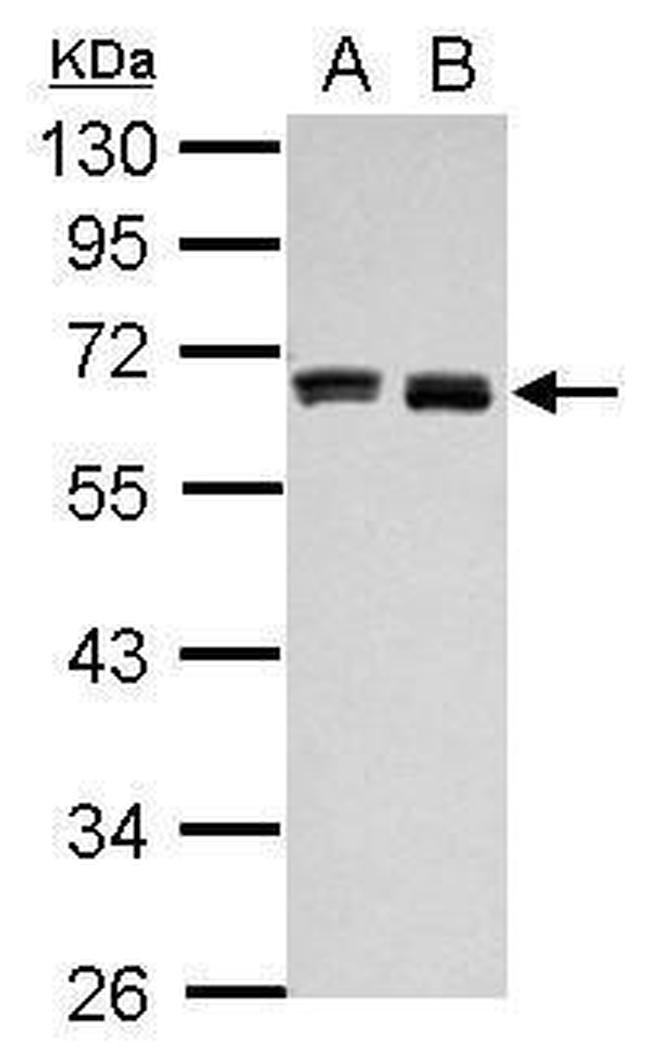 HAS3 Antibody in Western Blot (WB)