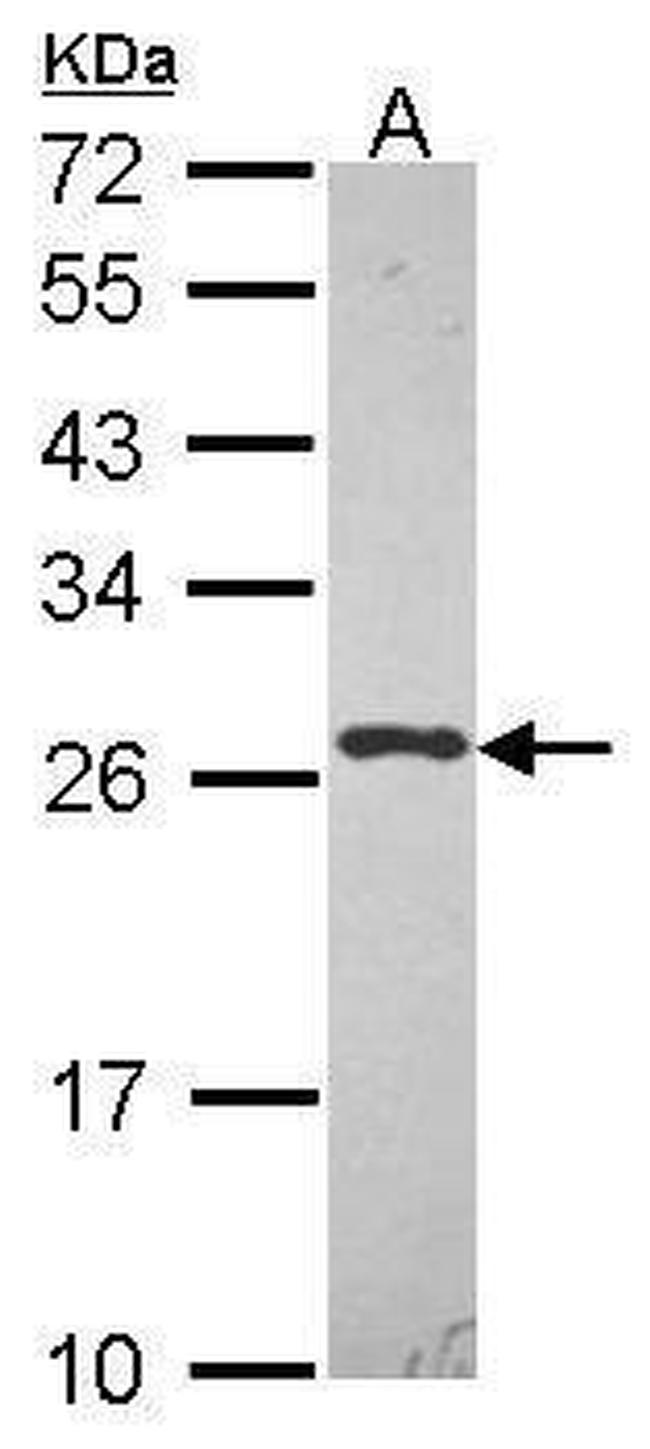 HIP2 Antibody in Western Blot (WB)