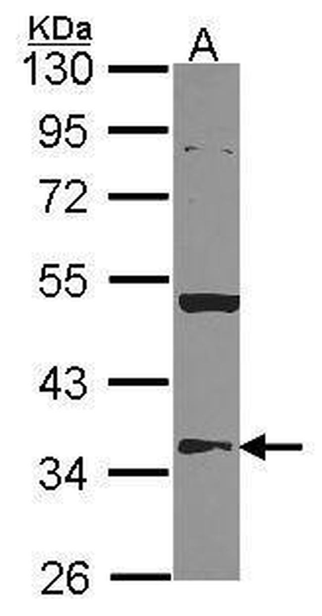 HMGCL Antibody in Western Blot (WB)