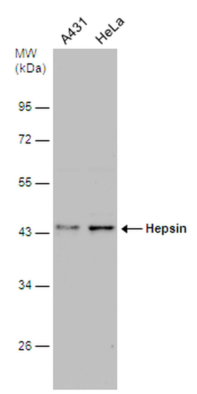 Hepsin Antibody in Western Blot (WB)