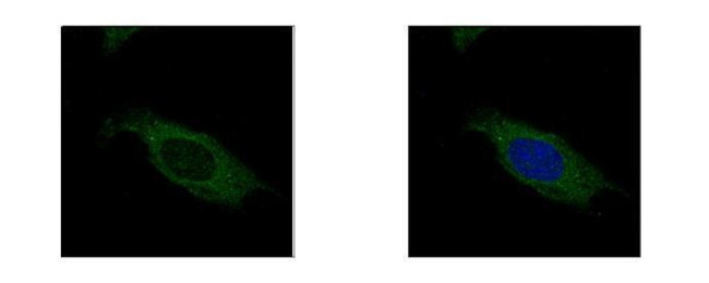 HSD17B3 Antibody in Immunocytochemistry (ICC/IF)