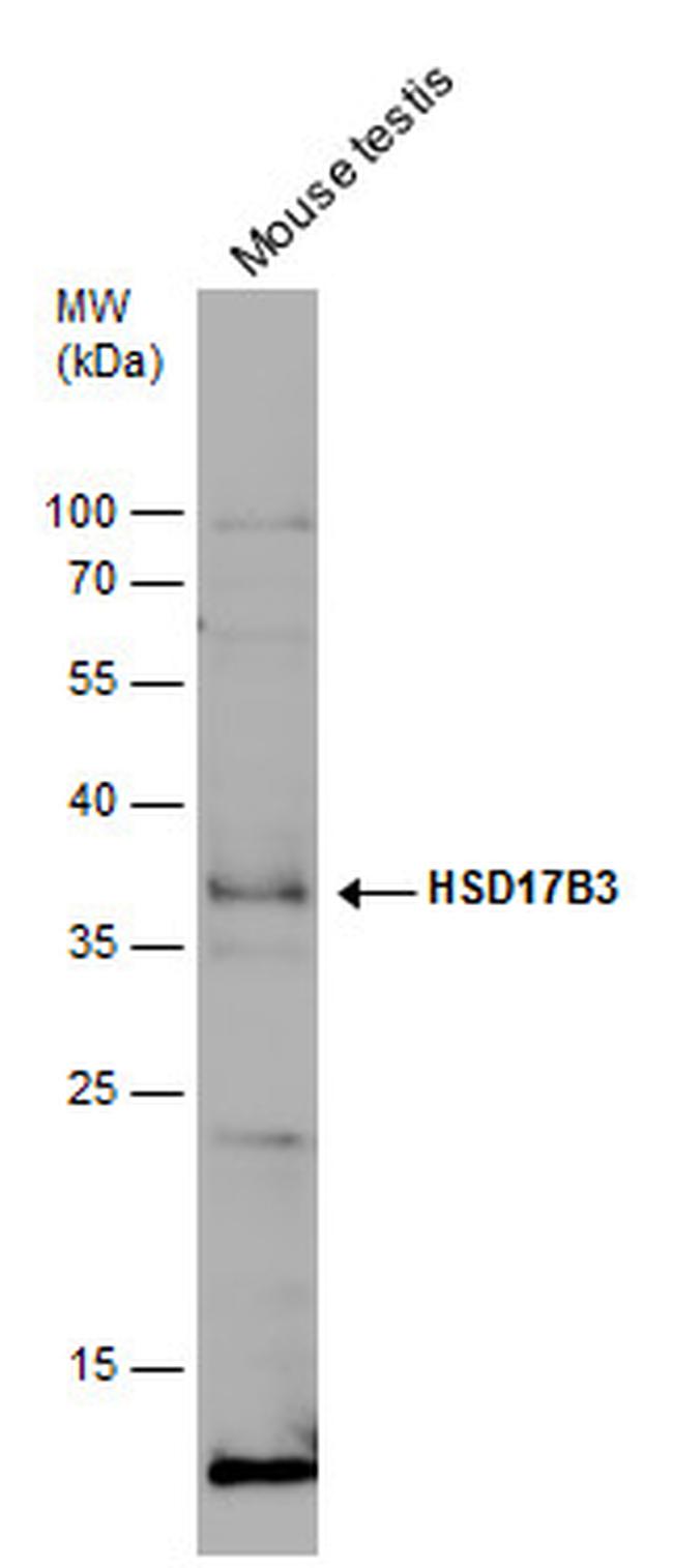 HSD17B3 Antibody in Western Blot (WB)