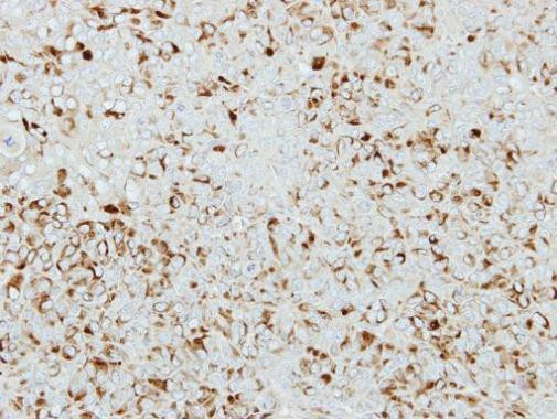 ICA1 Antibody in Immunohistochemistry (Paraffin) (IHC (P))