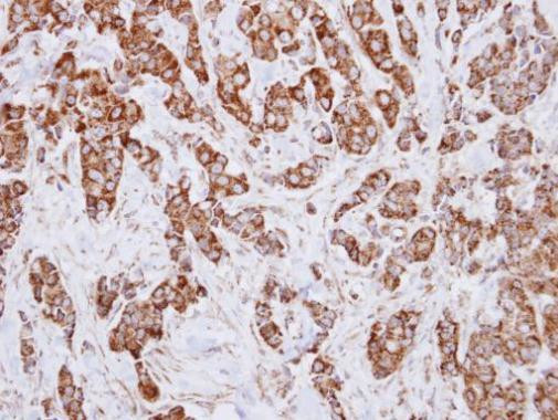 IDH3A Antibody in Immunohistochemistry (Paraffin) (IHC (P))