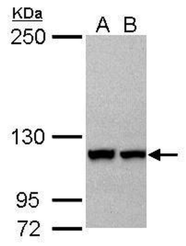 IPO5 Antibody in Western Blot (WB)