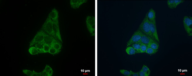 FADS1 Antibody in Immunocytochemistry (ICC/IF)