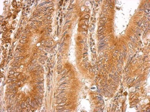 LMAN1 Antibody in Immunohistochemistry (Paraffin) (IHC (P))