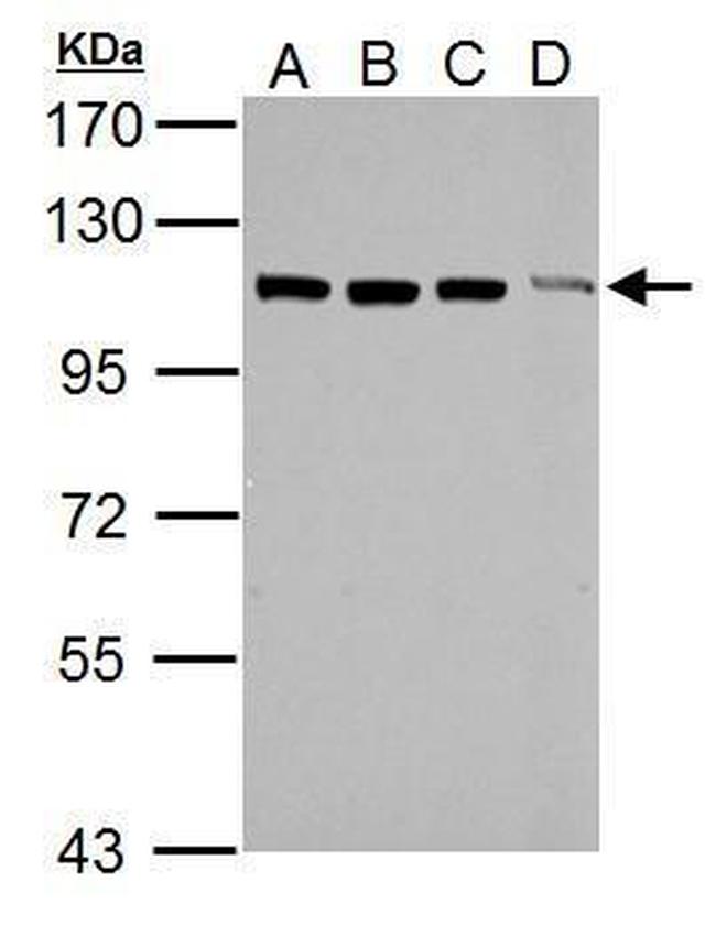 TRIM37 Antibody in Western Blot (WB)