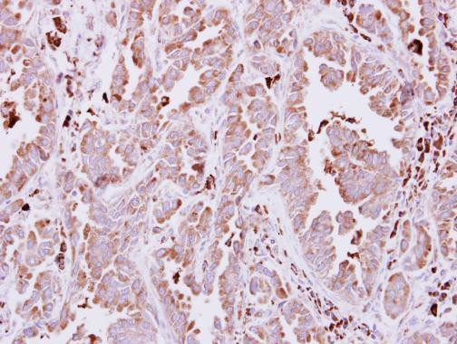 NAGLU Antibody in Immunohistochemistry (Paraffin) (IHC (P))