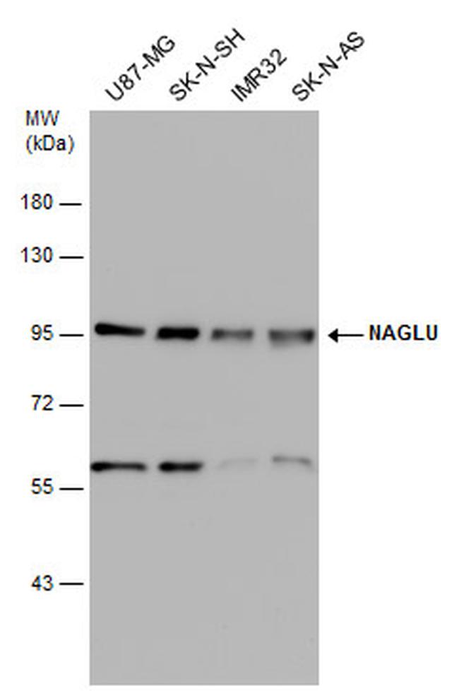 NAGLU Antibody in Western Blot (WB)