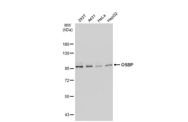 OSBP Antibody in Western Blot (WB)