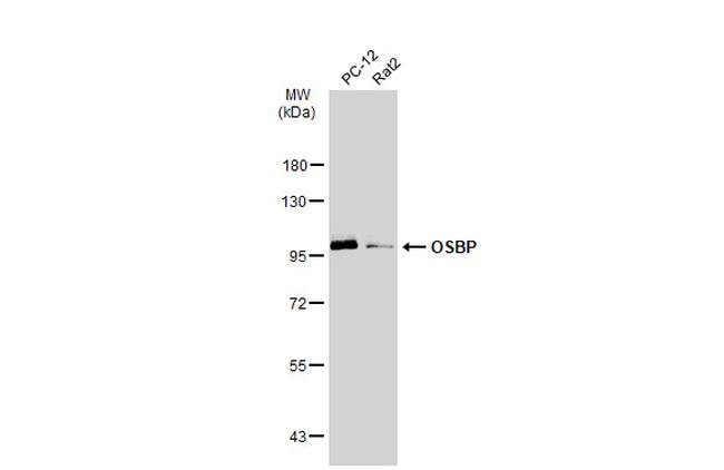 OSBP Antibody in Western Blot (WB)