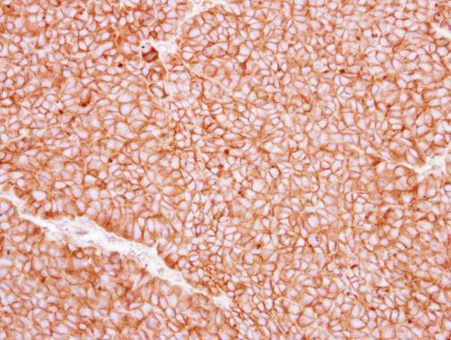 P2X5 Antibody in Immunohistochemistry (Paraffin) (IHC (P))