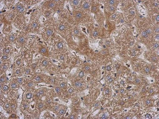 PABPC3 Antibody in Immunohistochemistry (Paraffin) (IHC (P))