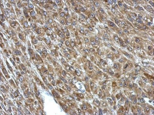 PCCA Antibody in Immunohistochemistry (Paraffin) (IHC (P))