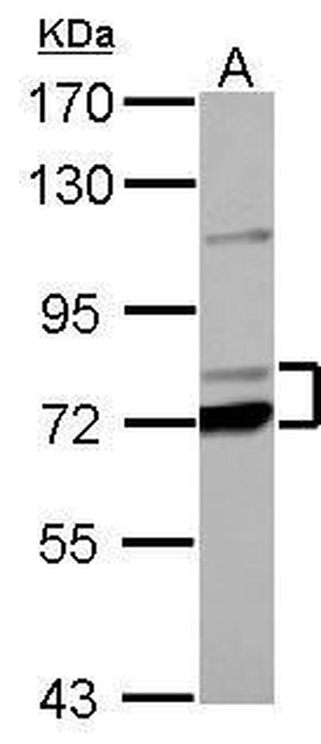 PCCA Antibody in Western Blot (WB)