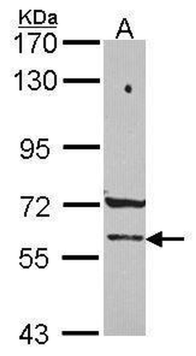 PCCB Antibody in Western Blot (WB)