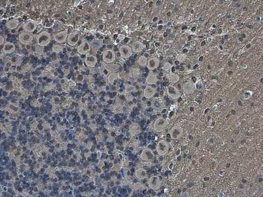 POU3F2 Antibody in Immunohistochemistry (Paraffin) (IHC (P))