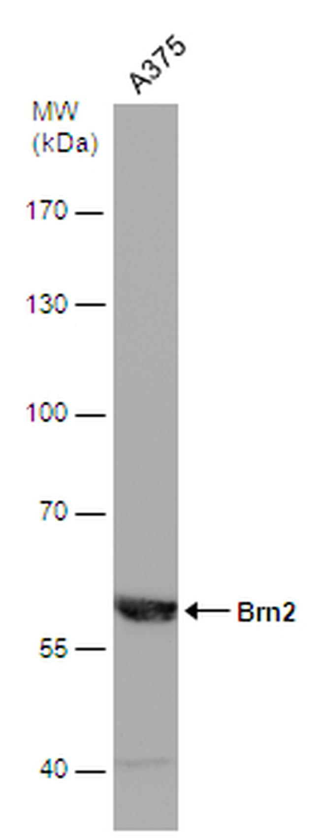 POU3F2 Antibody in Western Blot (WB)