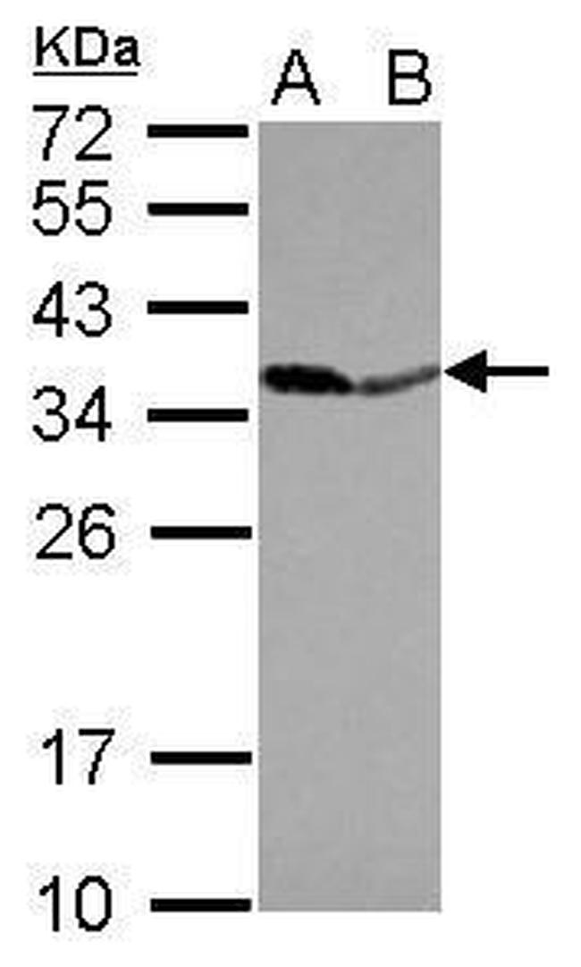 PPA1 Antibody in Western Blot (WB)