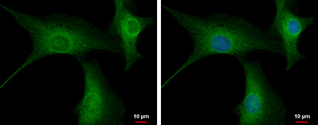 PPP2R3A Antibody in Immunocytochemistry (ICC/IF)