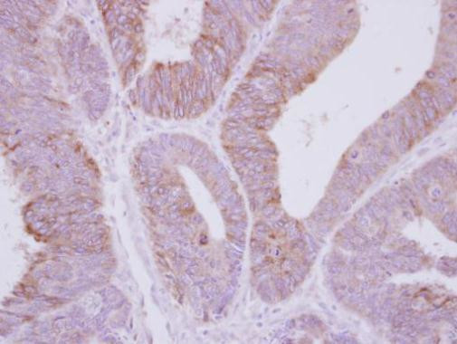 PPP2R3A Antibody in Immunohistochemistry (Paraffin) (IHC (P))