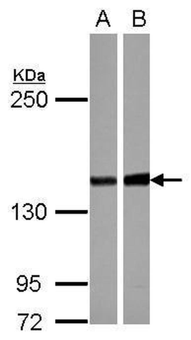 PPP2R3A Antibody in Western Blot (WB)