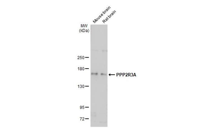 PPP2R3A Antibody in Western Blot (WB)