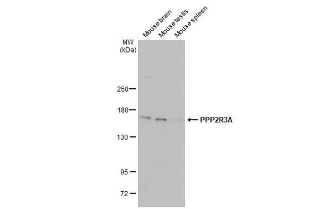 PPP2R3A Antibody in Western Blot (WB)