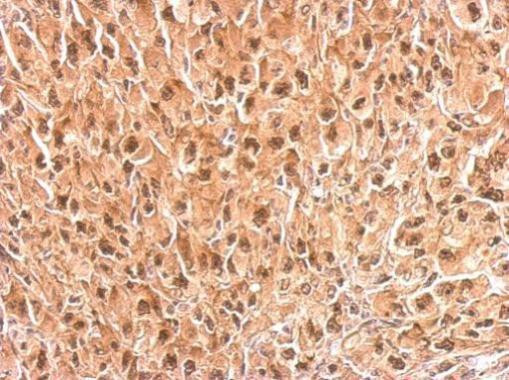 PSMC4 Antibody in Immunohistochemistry (Paraffin) (IHC (P))