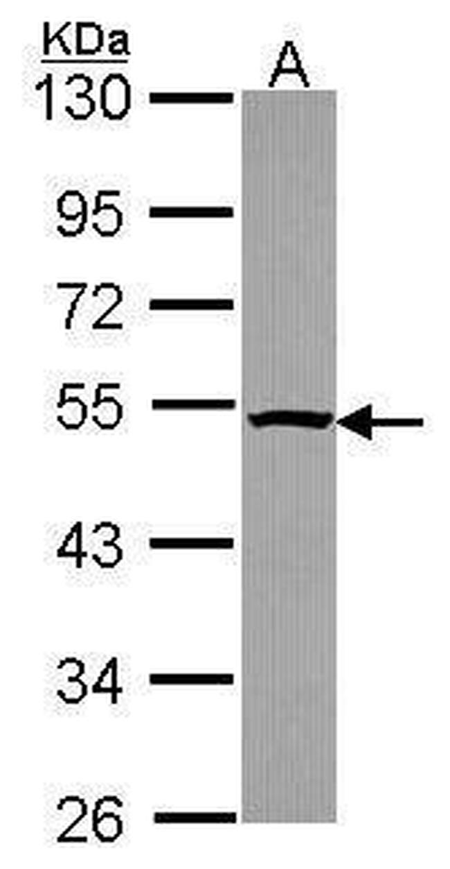 PSMC4 Antibody in Western Blot (WB)