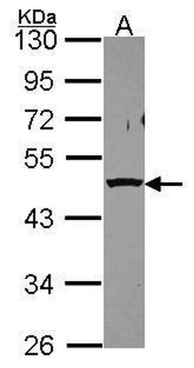 PSMC5 Antibody in Western Blot (WB)