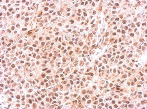 PSMC6 Antibody in Immunohistochemistry (Paraffin) (IHC (P))