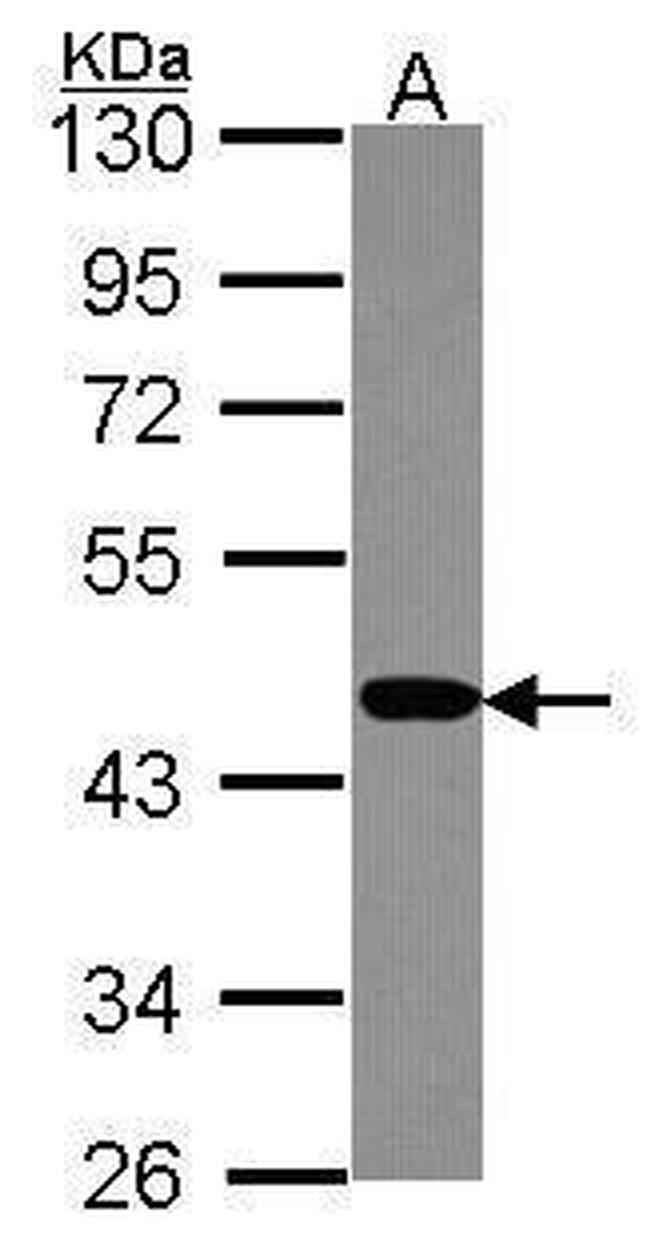 PSMC6 Antibody in Western Blot (WB)