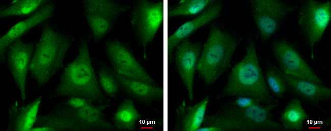 PSMD4 Antibody in Immunocytochemistry (ICC/IF)