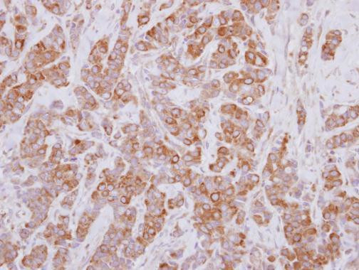 PSMD5 Antibody in Immunohistochemistry (Paraffin) (IHC (P))