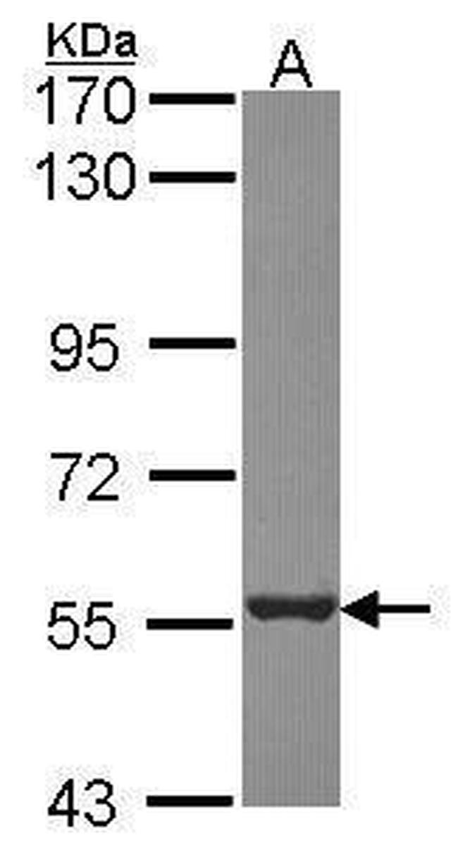 PSMD5 Antibody in Western Blot (WB)