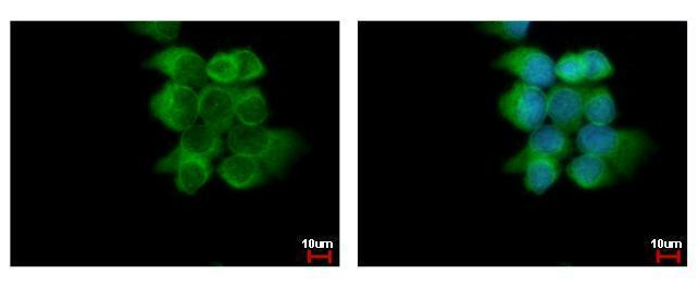 ABCD4 Antibody in Immunocytochemistry (ICC/IF)