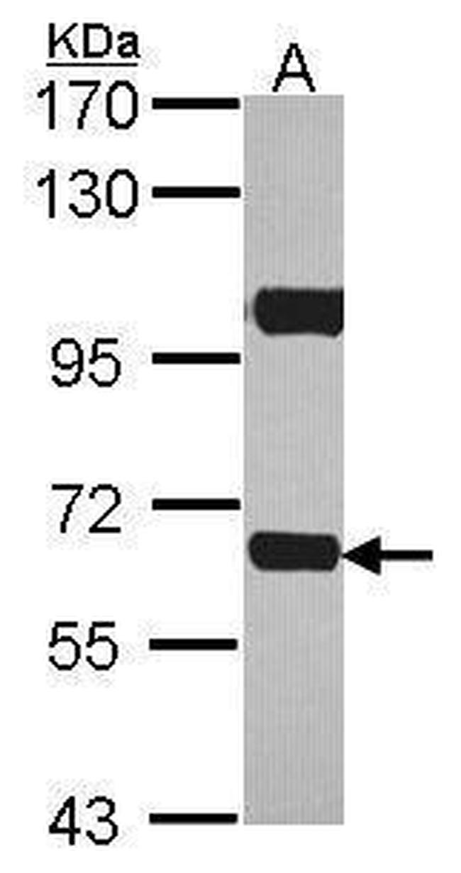 ABCD4 Antibody in Western Blot (WB)