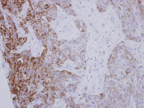 PYCR1 Antibody in Immunohistochemistry (Paraffin) (IHC (P))