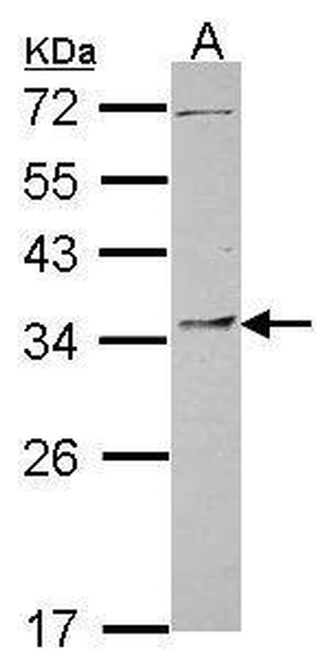 PYCR1 Antibody in Western Blot (WB)