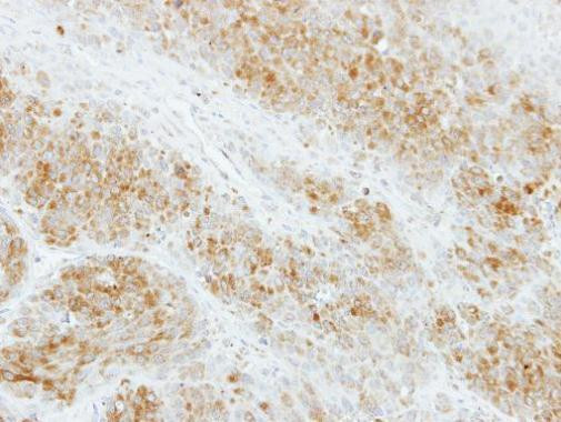 RAB2A Antibody in Immunohistochemistry (Paraffin) (IHC (P))