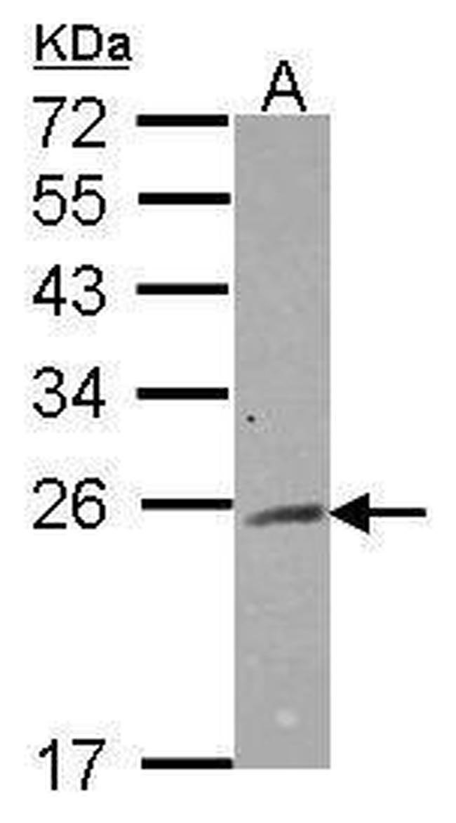 RAB2A Antibody in Western Blot (WB)