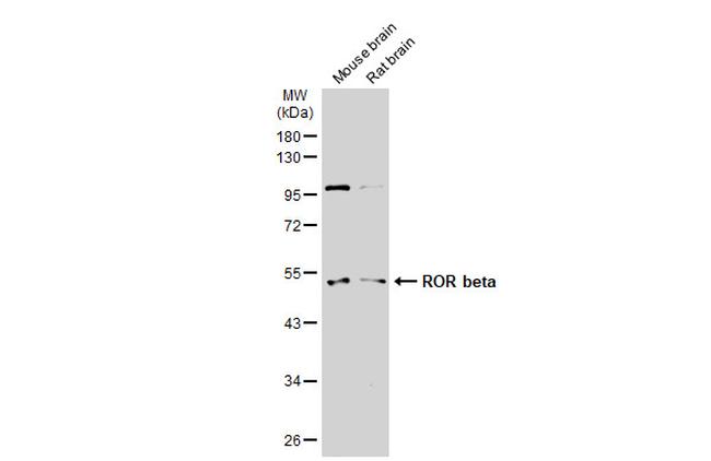 RORB Antibody in Western Blot (WB)