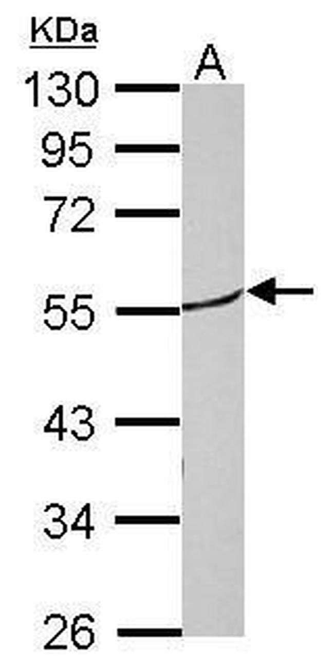 RORB Antibody in Western Blot (WB)