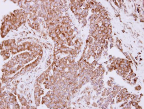 RPL7A Antibody in Immunohistochemistry (Paraffin) (IHC (P))