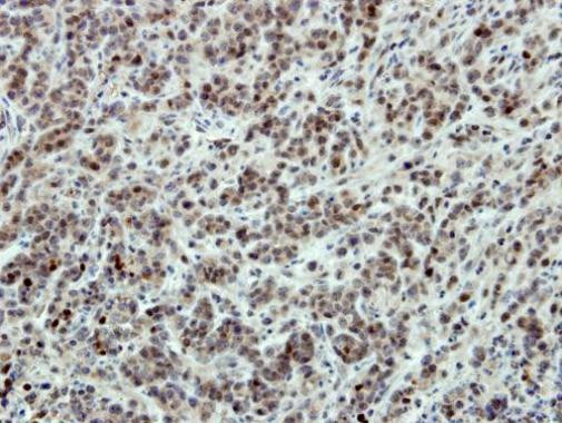 SATB1 Antibody in Immunohistochemistry (Paraffin) (IHC (P))